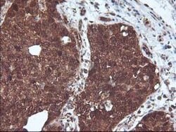 DSTN Mouse anti-Canine, Human, Clone: OTI1G8, lyophilized, TrueMAB 100