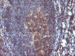 DSTN Mouse anti-Canine, Human, Clone: OTI1G8, lyophilized, TrueMAB 100