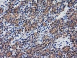 DSTN Monoclonal Antibody (OTI1C8), TrueMAB , OriGene 100 &mu;L; Unconjugated:Antibodies,