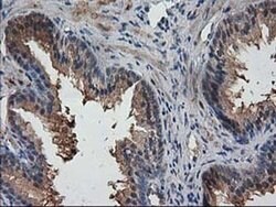 DSTN Monoclonal Antibody (OTI1C8), TrueMAB , OriGene 100 &mu;L; Unconjugated:Antibodies,