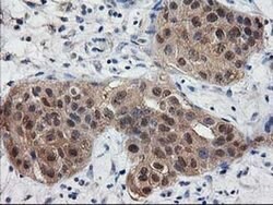 DSTN Monoclonal Antibody (OTI1C8), TrueMAB , OriGene 100 &mu;L; Unconjugated:Antibodies,