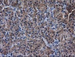 DSTN Mouse anti-Human, Clone: OTI1B8, lyophilized, TrueMAB 100 &mu;g; Unconjugated:Antibodies,