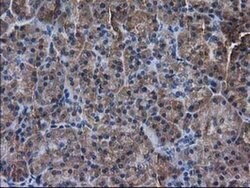 DSTN Monoclonal Antibody (OTI1B8), TrueMAB , OriGene 30 &mu;L; Unconjugated:Antibodies,