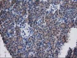 DSTN Mouse anti-Human, Clone: OTI1B8, lyophilized, TrueMAB 100 &mu;g; Unconjugated:Antibodies,