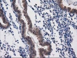DSTN Mouse anti-Human, Clone: OTI1B8, lyophilized, TrueMAB 100 &mu;g; Unconjugated:Antibodies,