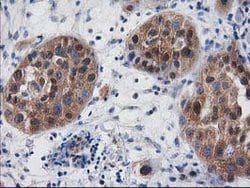 DSTN Mouse anti-Human, Clone: OTI1B8, lyophilized, TrueMAB 100 &mu;g; Unconjugated:Antibodies,