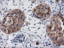 DSTN Monoclonal Antibody (OTI1B8), TrueMAB , OriGene:Antibodies:Primary