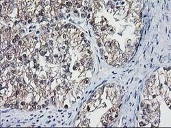 DSTN Monoclonal Antibody (OTI1C5), TrueMAB , OriGene 100 &mu;L; Unconjugated:Antibodies,
