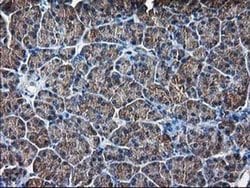 DSTN Monoclonal Antibody (OTI1C5), TrueMAB , OriGene 100 &mu;L; Unconjugated:Antibodies,