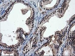 DSTN Monoclonal Antibody (OTI1C5), TrueMAB , OriGene 100 &mu;L; Unconjugated:Antibodies,