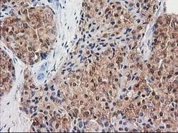 DSTN Monoclonal Antibody (OTI1C5), TrueMAB , OriGene 100 &mu;L; Unconjugated:Antibodies,