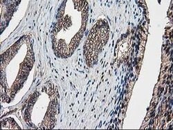 DSTN Monoclonal Antibody (OTI1C5), TrueMAB , OriGene 100 &mu;L; Unconjugated:Antibodies,