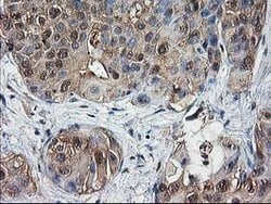 DSTN Mouse anti-Human, Rat, Clone: OTI1C5, lyophilized, TrueMAB 100 &mu;g;