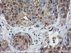 DSTN Monoclonal Antibody (OTI1C5), TrueMAB , OriGene 100 &mu;L; Unconjugated:Antibodies,