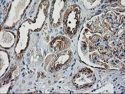DSTN Monoclonal Antibody (OTI1C5), TrueMAB , OriGene 100 &mu;L; Unconjugated:Antibodies,