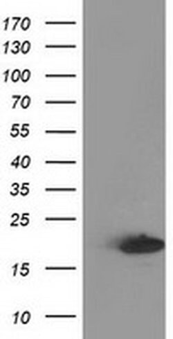 DSTN Mouse anti-Canine, Human, Clone: OTI2E10, liquid, TrueMAB 100 &mu;L;