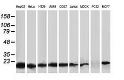 DSTN Mouse anti-Canine, Human, Clone: OTI2E10, liquid, TrueMAB 100 &mu;L;