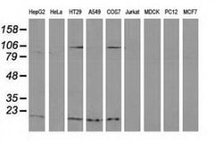 DSTN Monoclonal Antibody (OTI2E8), TrueMAB , OriGene 100 &mu;L | Buy Online | Origene Technologies | Fisher Scientific