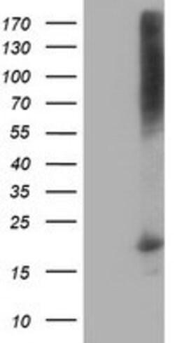DSTN Mouse anti-Canine, Human, Clone: OTI1G8, lyophilized, TrueMAB 100