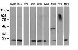 DSTN Mouse anti-Canine, Human, Clone: OTI1G8, lyophilized, TrueMAB 100