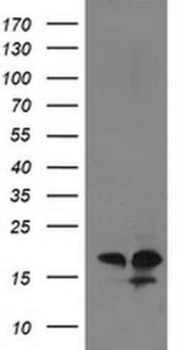 DSTN Monoclonal Antibody (OTI1C8), TrueMAB , OriGene 100 &mu;L; Unconjugated:Antibodies,
