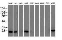 DSTN Monoclonal Antibody (OTI1C8), TrueMAB , OriGene 100 &mu;L; Unconjugated:Antibodies,