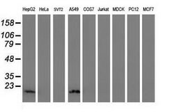 DSTN Mouse anti-Human, Clone: OTI1B8, lyophilized, TrueMAB 100 &mu;g; Unconjugated:Antibodies,