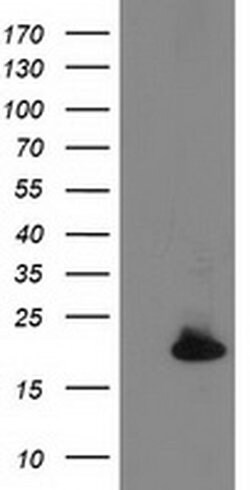DSTN Monoclonal Antibody (OTI1C5), TrueMAB , OriGene 100 &mu;L; Unconjugated:Antibodies,