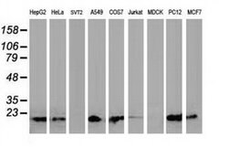 DSTN Monoclonal Antibody (OTI1C5), TrueMAB , OriGene 100 &mu;L; Unconjugated:Antibodies,