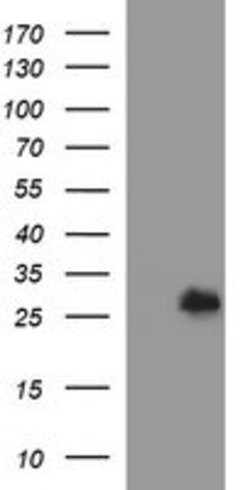 DTD1 Mouse anti-Human, Clone: OTI1E1, lyophilized, TrueMAB 100 &mu;g; Unconjugated:Antibodies,