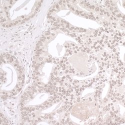 DTL/CDT2 Rabbit anti-Human, Mouse, Polyclonal, Bethyl Laboratories 100