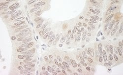 DTL/CDT2 Rabbit anti-Human, Polyclonal, Bethyl Laboratories 10 &mu;L; Unconjugated:Antibodies,