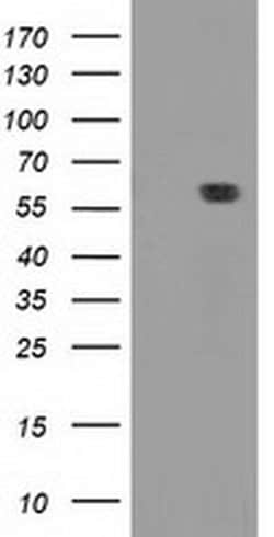 DTNA Monoclonal Antibody (OTI1B11), TrueMAB , OriGene 100 &mu;L; Unconjugated:Antibodies,