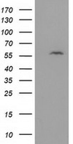 DTNA Monoclonal Antibody (OTI2F9), TrueMAB , OriGene 30 &mu;L; Unconjugated:Antibodies,