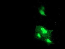 DTNB Monoclonal Antibody (OTI3A12), TrueMAB , OriGene 100 &mu;L; Unconjugated:Antibodies,