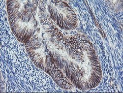 DTNB Monoclonal Antibody (OTI2E6), TrueMAB , OriGene:Antibodies:Primary