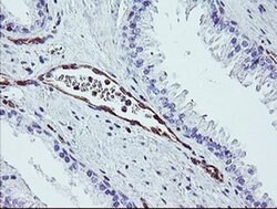 DTNB Monoclonal Antibody (OTI2E6), TrueMAB , OriGene 30 &mu;L; Unconjugated:Antibodies,