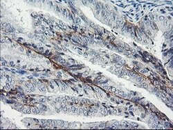 DTNB Monoclonal Antibody (OTI3A12), TrueMAB , OriGene 100 &mu;L; Unconjugated:Antibodies,