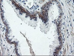 DTNB Monoclonal Antibody (OTI3A12), TrueMAB , OriGene 100 &mu;L; Unconjugated:Antibodies,