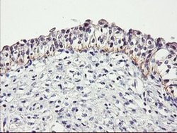DTNB Monoclonal Antibody (OTI3A12), TrueMAB , OriGene 100 &mu;L; Unconjugated:Antibodies,
