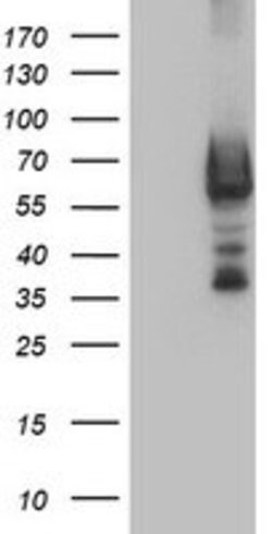 DTNB Mouse anti-Human, Clone: OTI3C11, lyophilized, TrueMAB 100 &mu;g;