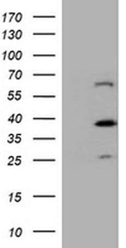 DTNB Monoclonal Antibody (OTI2E6), TrueMAB , OriGene:Antibodies:Primary