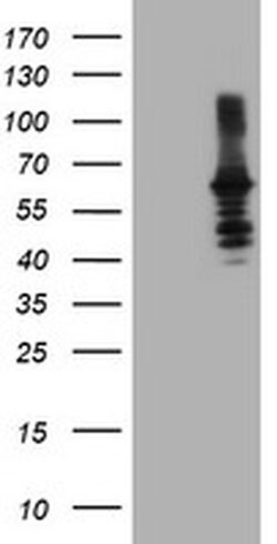 DTNB Monoclonal Antibody (OTI3A12), TrueMAB , OriGene 100 &mu;L; Unconjugated:Antibodies,