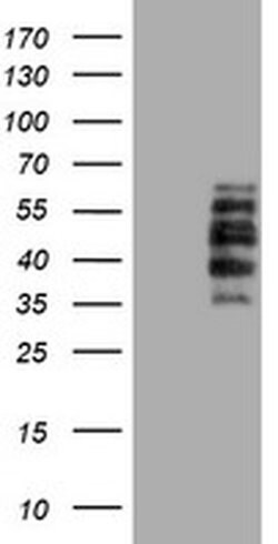 DTNB Monoclonal Antibody (OTI3H8), TrueMAB , OriGene 30 &mu;L | Buy Online | Origene Technologies | Fisher Scientific