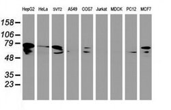 DTNB Monoclonal Antibody (OTI3H8), TrueMAB , OriGene 30 &mu;L | Buy Online | Origene Technologies | Fisher Scientific
