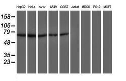 DTNB Mouse anti-Human, Mouse, Clone: OTI2E3, lyophilized, TrueMAB 100 &mu;g | Buy Online | Origene Technologies | Fisher Scientific
