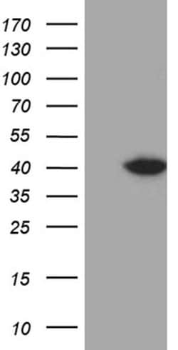 DTWD1 Monoclonal Antibody (OTI2C2), TrueMAB , OriGene 100 &mu;L; Unconjugated:Antibodies,