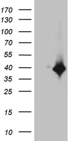 DTWD1 Monoclonal Antibody (OTI2D2), TrueMAB , OriGene 30 &mu;L | Buy Online | Origene Technologies | Fisher Scientific