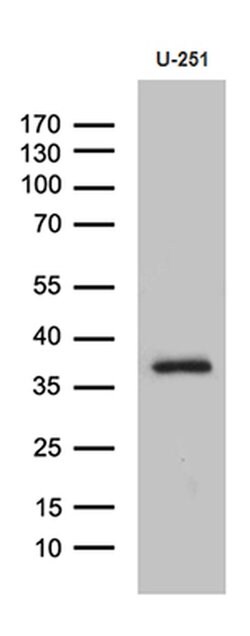 DTWD1 Monoclonal Antibody (OTI2D2), TrueMAB , OriGene 30 &mu;L | Buy Online | Origene Technologies | Fisher Scientific