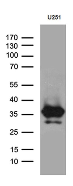 DTWD1 Monoclonal Antibody (OTI1E2), TrueMAB , OriGene:Antibodies:Primary